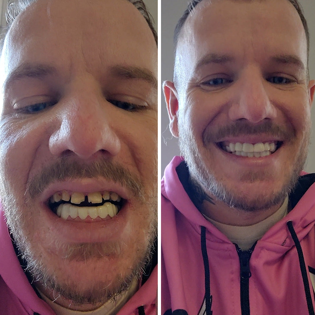 Feeling great with my new smile
